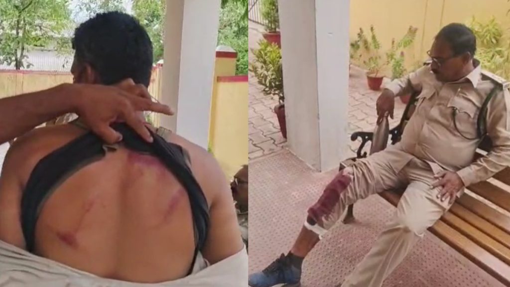 CG ब्रेकिंग : निरीक्षण करने पहुंची वन विभाग की टीम पर लाठी-डंडे से हमला, डिप्टी रेंजर समेत 4 घायल