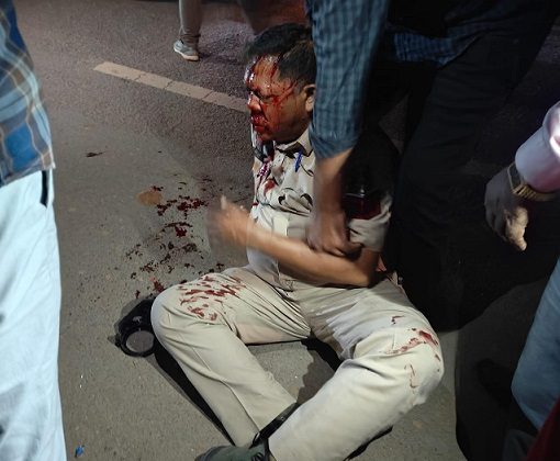 CG Accident: रेलवे ओवरब्रिज पर ट्रक से टकराई बाइक, हेड कांस्टेबल गंभीर रूप से घायल