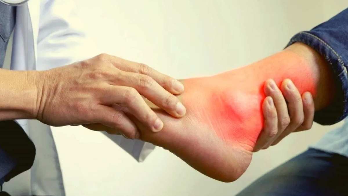 यूरिक एसिड बढ़ने से स्किन में नजर आने लगते हैं ये लक्षण, तो तुरंत करें डॉक्टर से संपर्क…