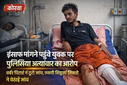 बर्बर पिटाई में टूटी जांघ